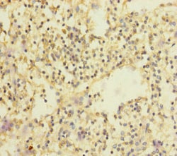 Invitrogen SLC35A1 Polyclonal Antibody 100 &mu;L | Buy Online | Invitrogen&trade; | Fisher Scientific