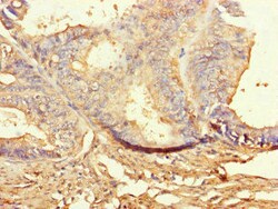 Invitrogen BUBR1 Polyclonal Antibody 100 &mu;g; Unconjugated:Antibodies,