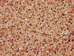 Invitrogen LATS1 Polyclonal Antibody 100 &mu;g; Unconjugated:Antibodies,