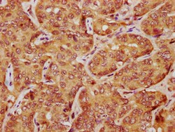 Invitrogen LATS1 Polyclonal Antibody 100 &mu;g; Unconjugated:Antibodies,