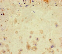 Invitrogen LATS1 Polyclonal Antibody 100 &mu;g; Unconjugated:Antibodies,