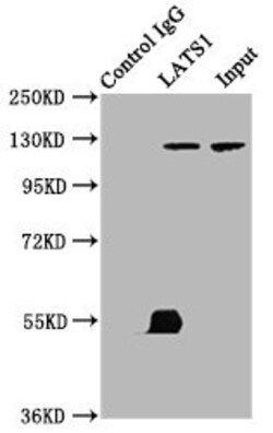 Invitrogen LATS1 Polyclonal Antibody 100 &mu;g; Unconjugated:Antibodies,