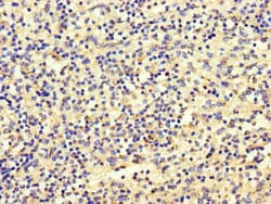 Invitrogen SBF2 Polyclonal Antibody 100 &mu;g | Buy Online | Invitrogen&trade; | Fisher Scientific