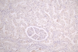 Invitrogen CCDC111 Polyclonal Antibody 100 &mu;g; Unconjugated:Antibodies,
