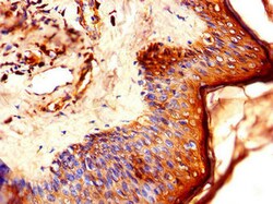 Invitrogen LCE1B Polyclonal Antibody 100 &mu;g; Unconjugated:Antibodies,