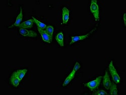 Invitrogen IFNL4 Polyclonal Antibody 100 &mu;g; Unconjugated:Antibodies,