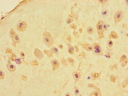 Invitrogen MEIKIN Polyclonal Antibody 100 &mu;g; Unconjugated:Antibodies,