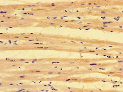 Invitrogen PKD1L3 Polyclonal Antibody 100 &mu;g | Buy Online | Invitrogen&trade; | Fisher Scientific