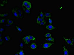 Invitrogen PPP1R12C Polyclonal Antibody 100 &mu;g; Unconjugated:Antibodies,