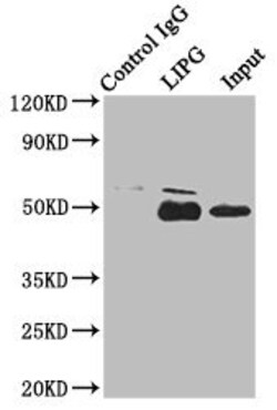 Invitrogen LIPG Polyclonal Antibody 100 &mu;g | Buy Online | Invitrogen&trade; | Fisher Scientific