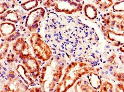 Invitrogen TDRD12 Polyclonal Antibody 100 &mu;g; Unconjugated:Antibodies,