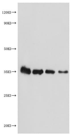 Invitrogen MALD1 Polyclonal Antibody 100 &mu;g; Unconjugated:Antibodies,