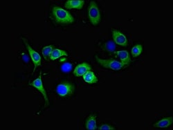 Invitrogen DR4 Polyclonal Antibody 100 &mu;g; Unconjugated:Antibodies,
