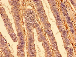 Invitrogen DR4 Polyclonal Antibody 100 &mu;g; Unconjugated:Antibodies,