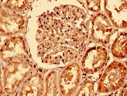 Invitrogen DR4 Polyclonal Antibody 100 &mu;g; Unconjugated:Antibodies,