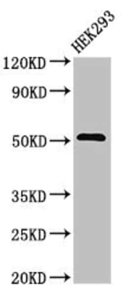 Invitrogen DR4 Polyclonal Antibody 100 &mu;g; Unconjugated:Antibodies,