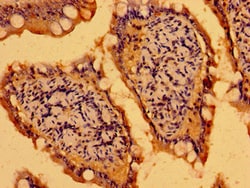 Invitrogen C19orf12 Polyclonal Antibody 100 &mu;g; Unconjugated:Antibodies,