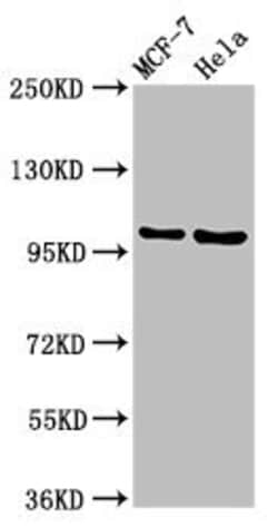 Invitrogen NUP98 Polyclonal Antibody 100 &mu;g; Unconjugated:Antibodies,