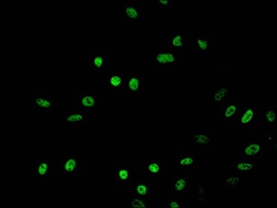 Invitrogen Acetyl-HIST1H2BB (Lys16) Polyclonal Antibody 100 &mu;L; Unconjugated:Antibodies,