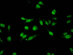 H3K27me1 Polyclonal Antibody:Antibodies, Polyclonal