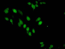 Invitrogen H3R17me1 Polyclonal Antibody 100 &mu;L; Unconjugated:Antibodies,