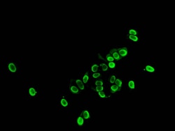 Invitrogen Acetyl-Histone H1.4 (Lys33) Polyclonal Antibody 100 &mu;L | Buy Online | Invitrogen&trade; | Fisher Scientific