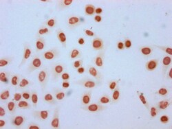 Invitrogen Formyl-HIST1H2AG (Lys95) Polyclonal Antibody 100 &mu;L; Unconjugated:Antikörper