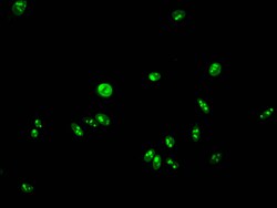 Invitrogen Formyl-HIST1H2AG (Lys95) Polyclonal Antibody 100 &mu;L; Unconjugated:Antikörper