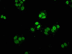 Invitrogen Mono-methyl-HIST1H2AG (Lys9) Polyclonal Antibody 100 &mu;L;