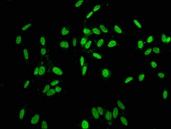 Invitrogen Phospho-Histone H1.2 (Thr164) Polyclonal Antibody 100 &mu;L;