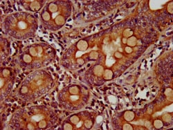 Invitrogen ZIC5 Polyclonal Antibody 100 &mu;g; Unconjugated:Antibodies,