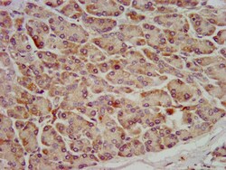 Invitrogen OCC1 Polyclonal Antibody 100 &mu;g; Unconjugated:Antibodies,