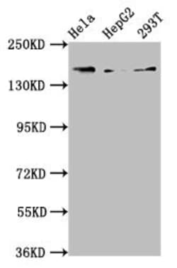 Invitrogen Complement C4 Polyclonal Antibody 100 &mu;g; Unconjugated:Antibodies,
