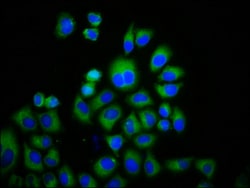 Invitrogen TRPM3 Polyclonal Antibody 100 &mu;g; Unconjugated:Antibodies,