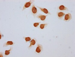 Invitrogen Acetyl-HIST1H2BC (Lys108) Polyclonal Antibody 100 &mu;L; Unconjugated:Anticuerpos