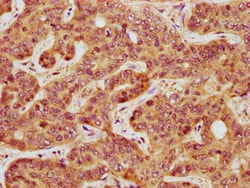 Invitrogen GATS Polyclonal Antibody 100 &mu;g; Unconjugated:Antibodies,