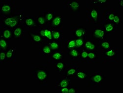 Invitrogen Acetyl-Histone H1.2 (Lys74) Polyclonal Antibody 100 &mu;L; Unconjugated:Antibodies,