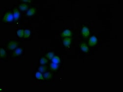 Invitrogen S100A7 Polyclonal Antibody 100 &mu;L; Unconjugated:Antibodies,
