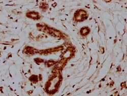 Invitrogen S100A7 Polyclonal Antibody 100 &mu;L; Unconjugated:Antibodies,