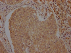 Invitrogen ATF6 Polyclonal Antibody 100 &mu;L; Unconjugated:Antibodies,