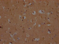 Invitrogen OR10A2 Polyclonal Antibody 100 &mu;L; Unconjugated:Antibodies,