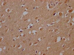 OR10A2 Polyclonal Antibody:Antibodies, Polyclonal