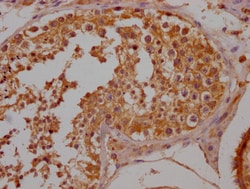 OR10A2 Polyclonal Antibody:Antibodies, Polyclonal