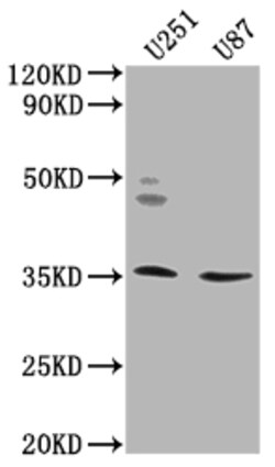 Invitrogen OR5K2 Polyclonal Antibody 100 &mu;L; Unconjugated:Antibodies,