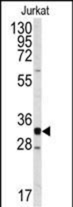 Invitrogen CDK2 Polyclonal Antibody 400 &mu;L; Unconjugated:Antibodies,