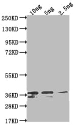 Invitrogen Venezuelan Equine Encephalitis Virus NSP1