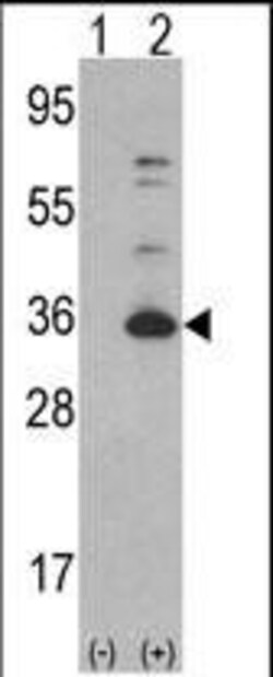 Invitrogen CDK4 Polyclonal Antibody 400 &mu;L; Unconjugated:Anticorps,