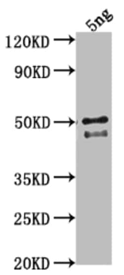 Invitrogen DGAT3 Polyclonal Antibody 100 &mu;L; Unconjugated:Antibodies,