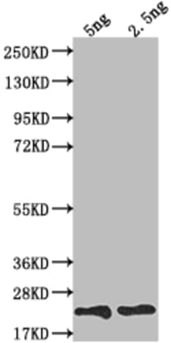 Invitrogen TRBC2 Polyclonal Antibody 100 &mu;L; Unconjugated:Antibodies,