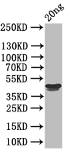 Invitrogen RH5 Polyclonal Antibody 100 &mu;L; Unconjugated:Antibodies,
